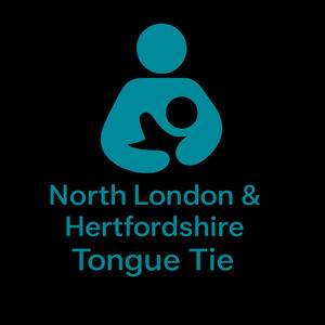 bottle feeding North London and Hertfordshire Tongue Tie